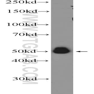 A4GALT Antibody - alpha 1,4-galactosyltransferase
