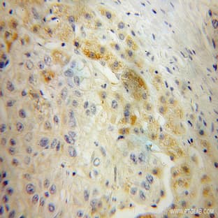AADAT Antibody - aminoadipate aminotransferase