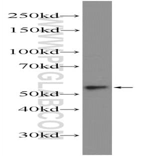 ACSF2 Antibody - acyl-CoA synthetase family member 2