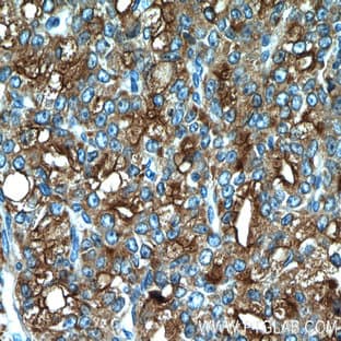acid phosphatase, prostate Antibody - acid phosphatase, prostate