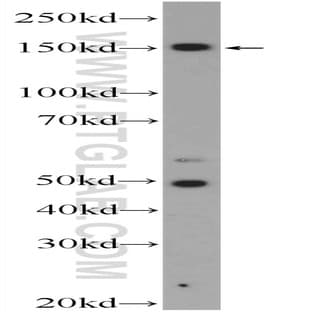 ZRANB3 Antibody - zinc finger, RAN-binding domain containing 3 avatar