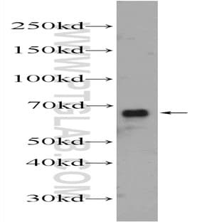 ACOT12 Antibody - acyl-CoA thioesterase 12
