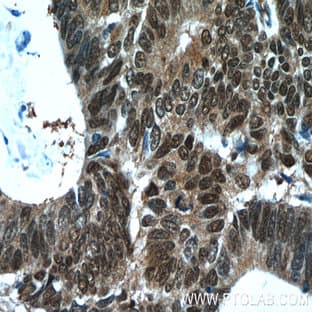 ZWILCH Antibody - Zwilch, kinetochore associated, homolog (Drosophila) avatar