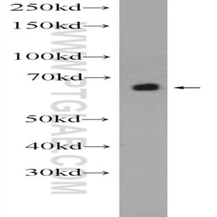 ACSM5 Antibody - acyl-CoA synthetase medium-chain family member 5