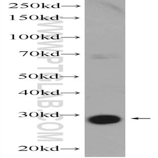 AACS Antibody - acetoacetyl-CoA synthetase