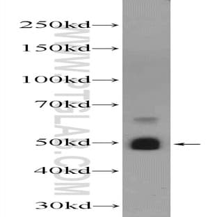 ZRANB2 Antibody - zinc finger, RAN-binding domain containing 2 avatar