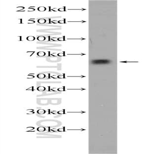 ACSM2A Antibody - acyl-CoA synthetase medium-chain family member 2A