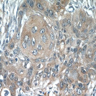 ACP1 Antibody - acid phosphatase 1, soluble
