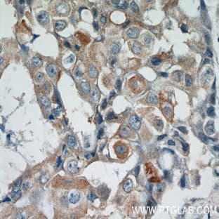 ACP5 Antibody - acid phosphatase 5, tartrate resistant