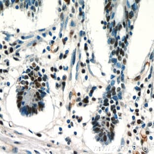 ZSCAN20 Antibody - zinc finger and SCAN domain containing 20 avatar