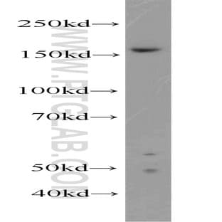 ZZZ3 Antibody - zinc finger, ZZ-type containing 3 avatar