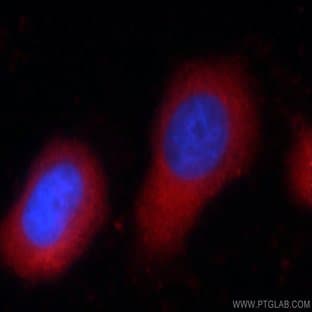Zyxin Antibody - zyxin avatar