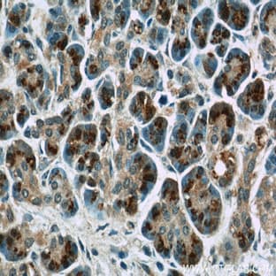 4EBP1 Antibody - eukaryotic translation initiation factor 4E binding protein 1
