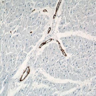 ACTA2/smooth muscle actin Antibody - actin, alpha 2, smooth muscle, aorta