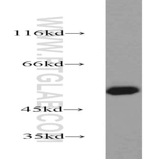 ZSCAN21 Antibody - zinc finger and SCAN domain containing 21 avatar