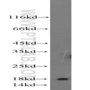 A2LD1 Antibody - AIG2-like domain 1