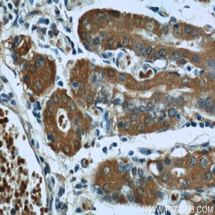 A4GNT Antibody - alpha-1,4-N-acetylglucosaminyltransferase