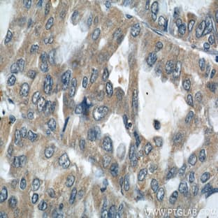 AARS2 Antibody - alanyl-tRNA synthetase 2, mitochondrial (putative)