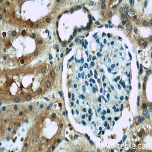 ACOT6 Antibody - acyl-CoA thioesterase 6