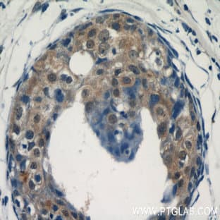 ACK1 Antibody - tyrosine kinase, non-receptor, 2