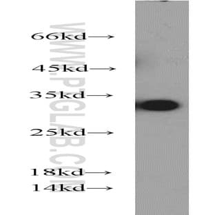 14-3-3 Antibody - tyrosine 3-monooxygenase/tryptophan 5-monooxygenase activation protein, theta polypeptide