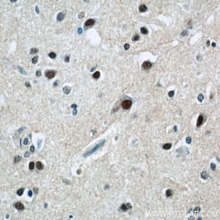 ZNF597 Antibody - zinc finger protein 597