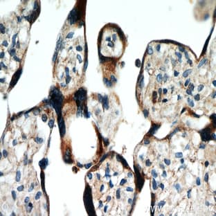 AAMP Antibody - angio-associated, migratory cell protein