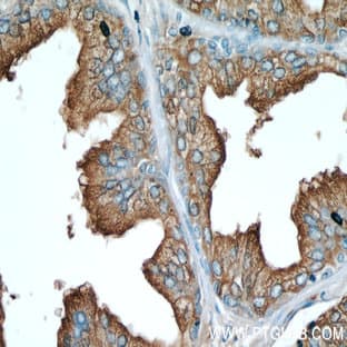 ACPP Antibody - acid phosphatase, prostate