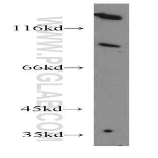 Aconitase 1 Antibody - aconitase 1, soluble