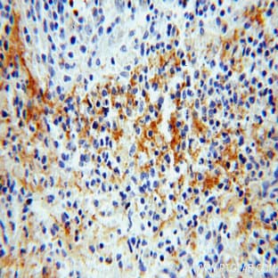 ADAP2 Antibody - ArfGAP with dual PH domains 2 avatar