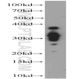 ACRV1 Antibody - acrosomal vesicle protein 1
