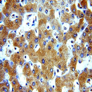 A1BG Antibody - alpha-1-B glycoprotein