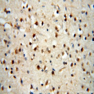 AADACL1 Antibody - arylacetamide deacetylase-like 1