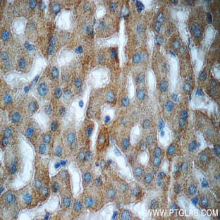ACHE Antibody - acetylcholinesterase (Yt blood group)