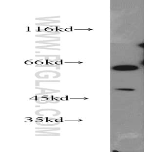 ACP2 Antibody - acid phosphatase 2, lysosomal
