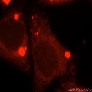 ACOX2 Antibody - acyl-Coenzyme A oxidase 2, branched chain