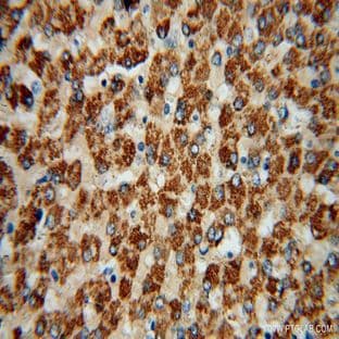 ACSS3 Antibody - acyl-CoA synthetase short-chain family member 3