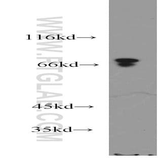 ACSS1 Antibody - acyl-CoA synthetase short-chain family member 1