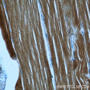 ACTA1-Specific Antibody - actin, alpha 1, skeletal muscle