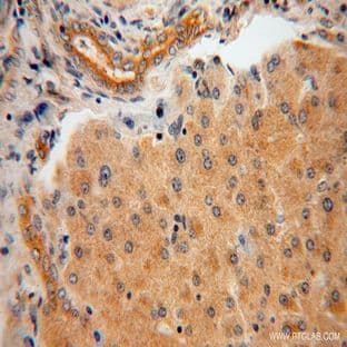 AARE Antibody - N-acylaminoacyl-peptide hydrolase