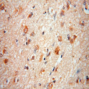 ACOT7 Antibody - acyl-CoA thioesterase 7