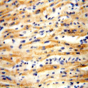 ACOT2 Antibody - acyl-CoA thioesterase 2