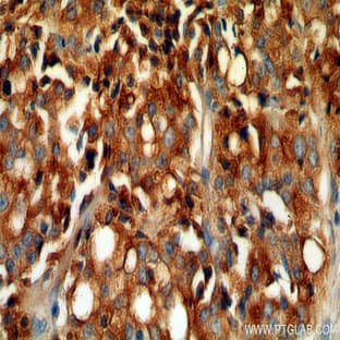acid phosphatase, prostate Antibody - acid phosphatase, prostate