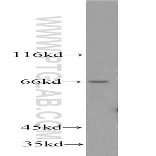 ACSL5 Antibody - acyl-CoA synthetase long-chain family member 5