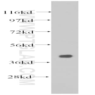 AARSD1 Antibody - alanyl-tRNA synthetase domain containing 1