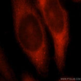 14-3-3 Antibody - tyrosine 3-monooxygenase/tryptophan 5-monooxygenase activation protein, theta polypeptide