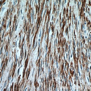 ACTA2/smooth muscle actin Antibody - actin, alpha 2, smooth muscle, aorta