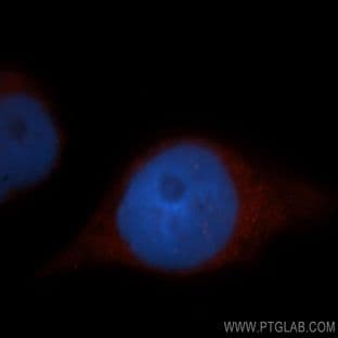 ADAP1 Antibody - ArfGAP with dual PH domains 1 avatar