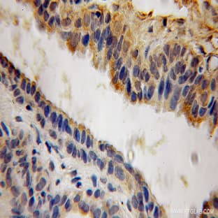 ACP6 Antibody - acid phosphatase 6, lysophosphatidic