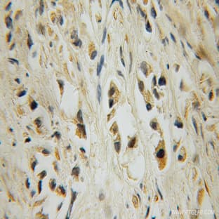 15 Lipoxygenase 2 Antibody - arachidonate 15-lipoxygenase, type B